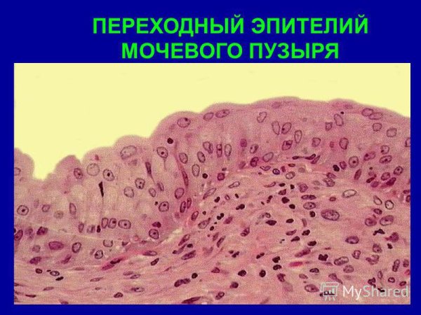 Переходный эпителий схема