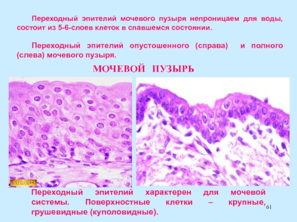 Почечный эпителий в моче микроскопия
