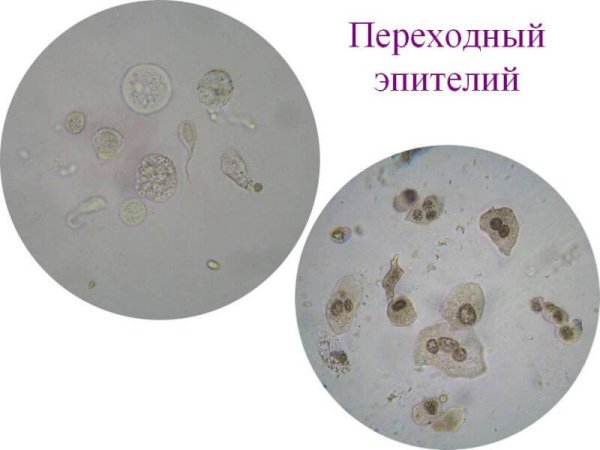 Многослойный эпителий мочевого пузыря