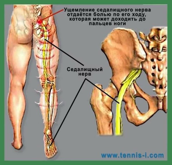 Седалищный нерв схема