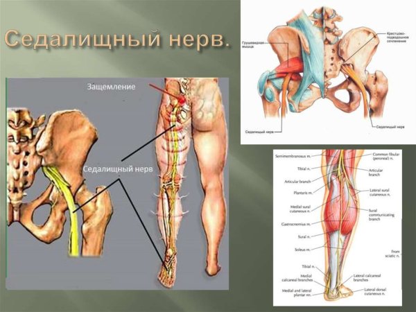 Защемление седалищного нерва анатомия