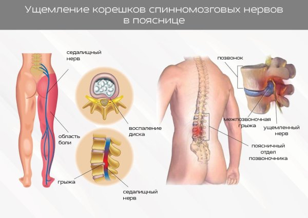 Седалищный нерв