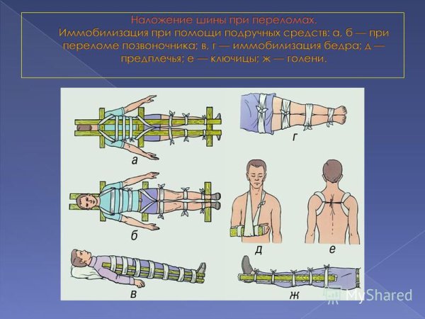 Наложение шины