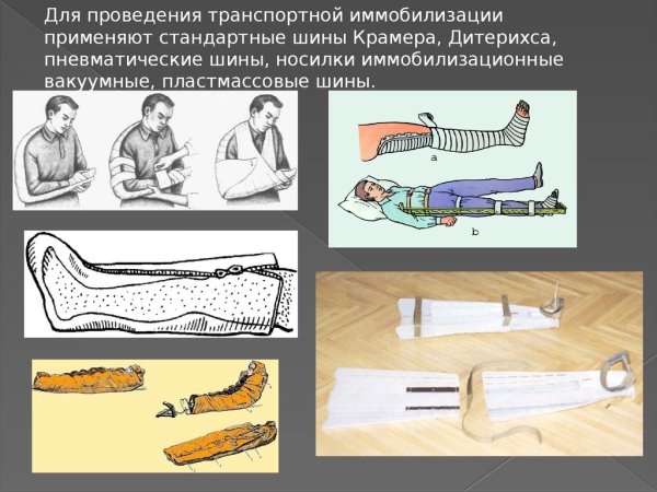 Стандартными шинами (Крамера-Дитерихса)