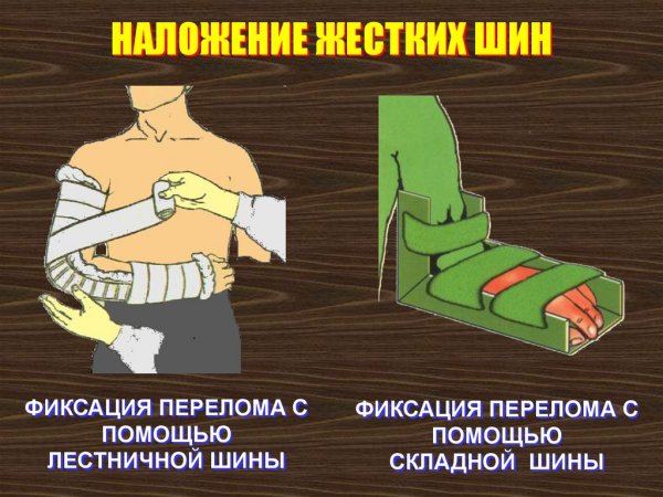 Наложение шины