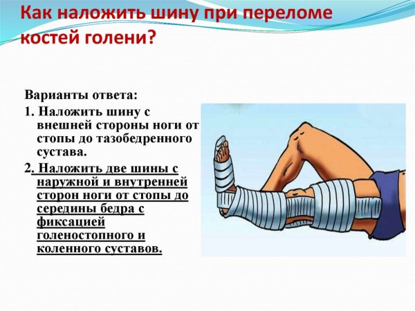 При переломах костей конечностей накладывается шина ответ на тест