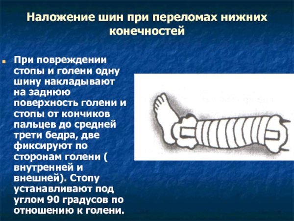 Наложить шину при переломе