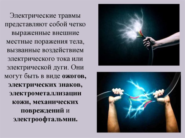 Воздействие электрического тока на человека