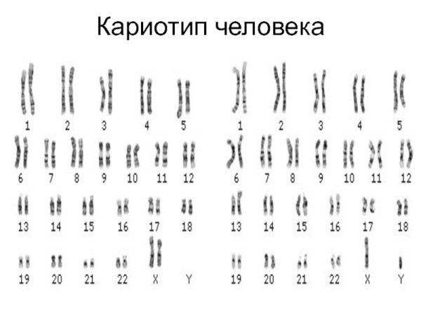 Нормальный кариотип хромосомы