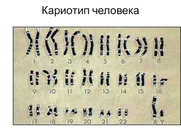 Нормальный кариотип человека рисунок