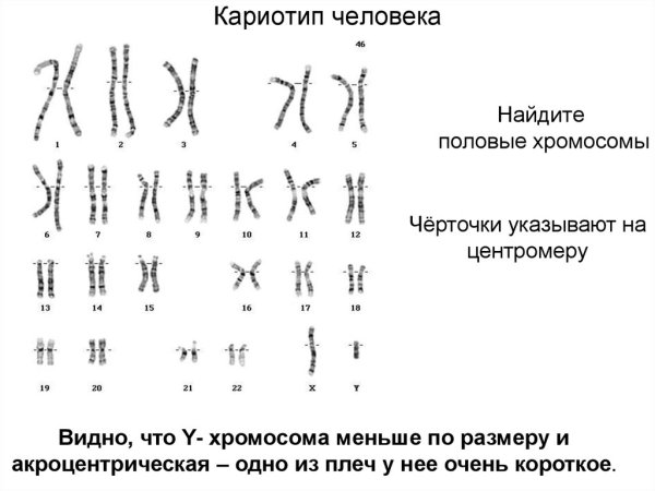 Кариограмма хромосом мужчины