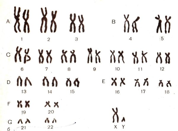Кариотип человека классификация хромосом человека