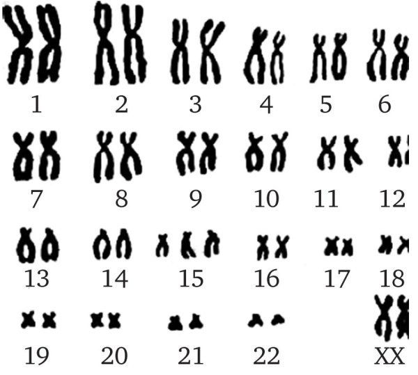 Кариотип человека набор хромосом