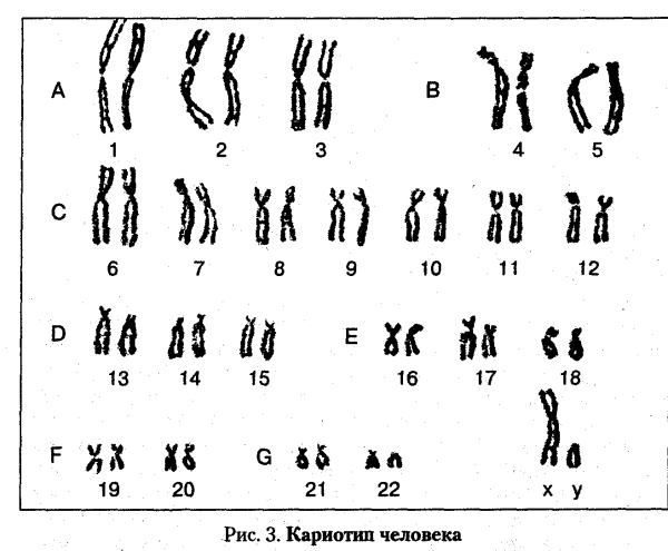Показания для исследования кариотипа