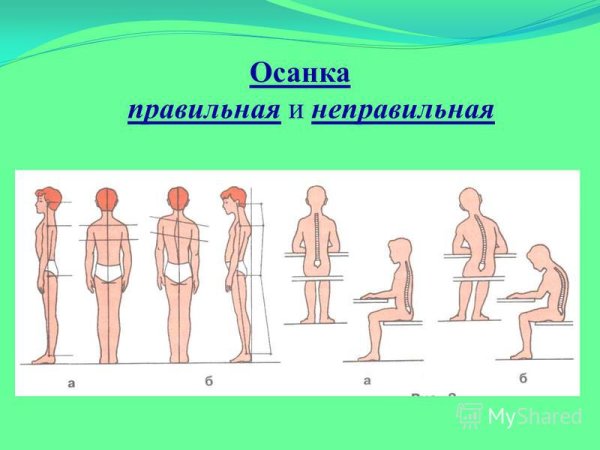 Правильная и неправильная осанка