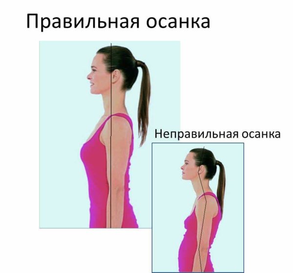 Правильная осанка у человека