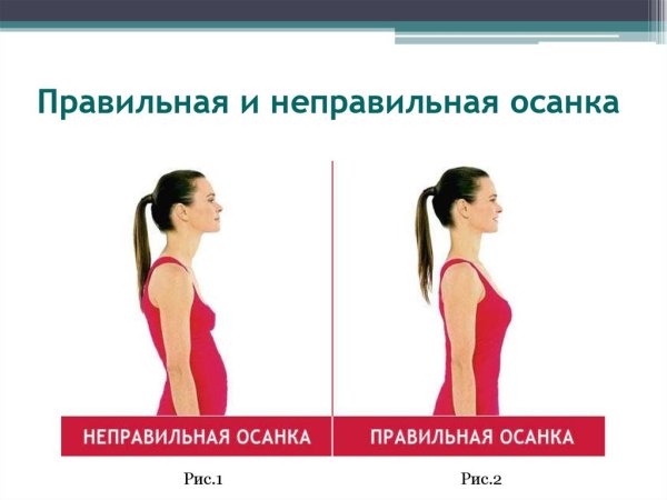 Правильная и неправильная осанка