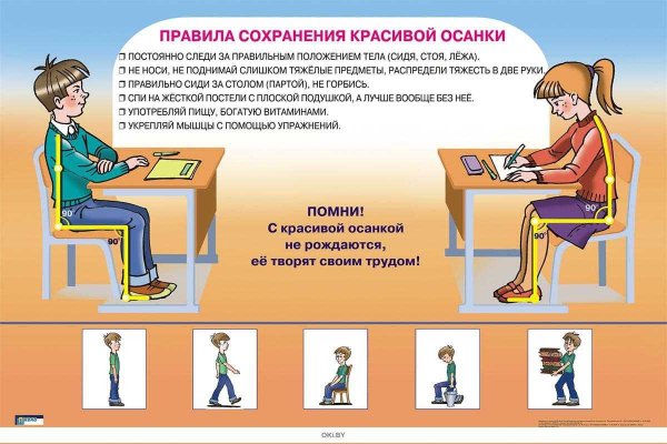 Неправильная осанка