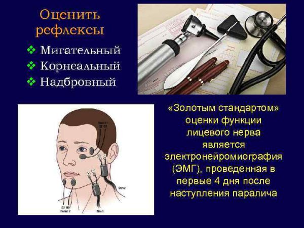 Периостальные рефлексы неврология