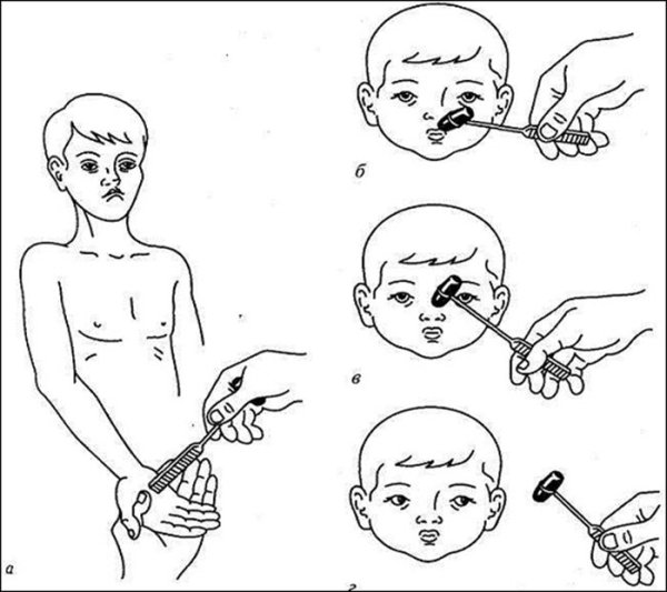 Надбровный рефлекс чувствительное ядро