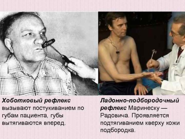 Схема рефлекторной дуги защитного сгибательного рефлекса