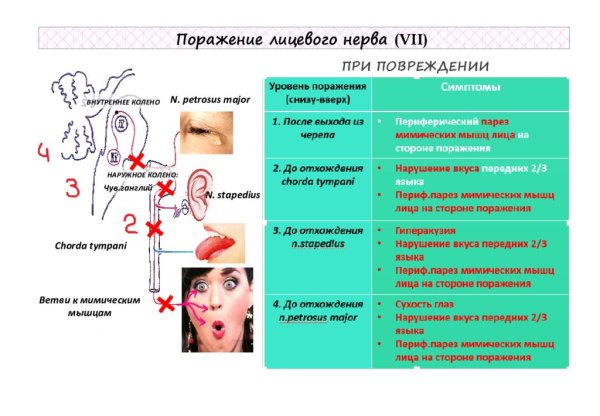 Сухожильный рефлекс схема