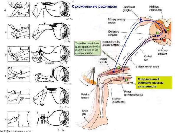 Исследование рефлекса Маринеску Радовичи