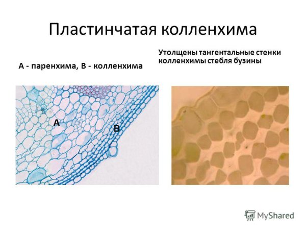 Механическая ткань растений склеренхима