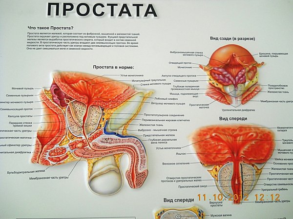 Аденома предстательной железы (аденома простаты)