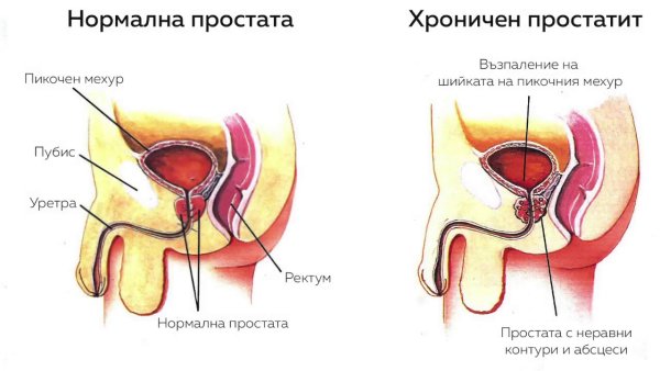 Простата у мужчин