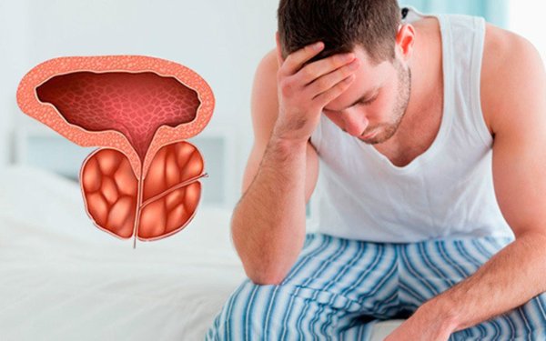 Предстательная железа, Prostata