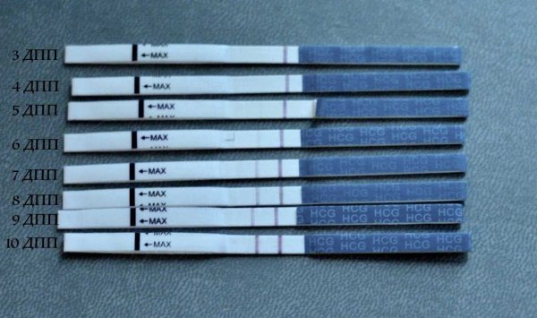 5 ДПП пятидневок тест