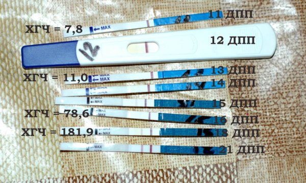 Тесты ХГЧ после переноса 5 дневок