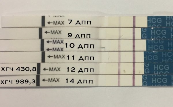 Тесты на беременность после криопереноса по дням