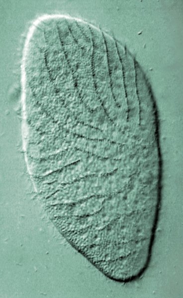 Opalina ranarum опалина Лягушачья