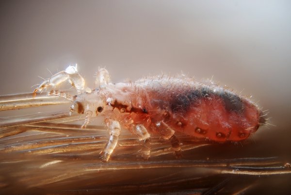 Головная вошь - Pediculus capitis