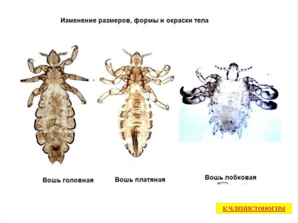 Вошь человеческая под микроскопом