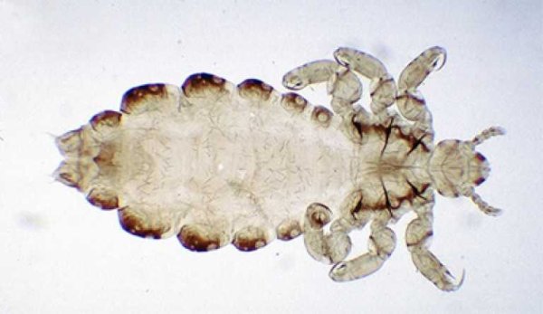 Головная вошь (Pediculus humanus capitis)
