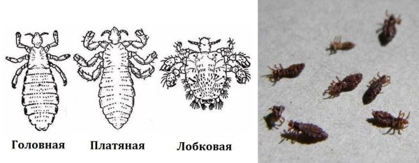 Платяная вошь отряд