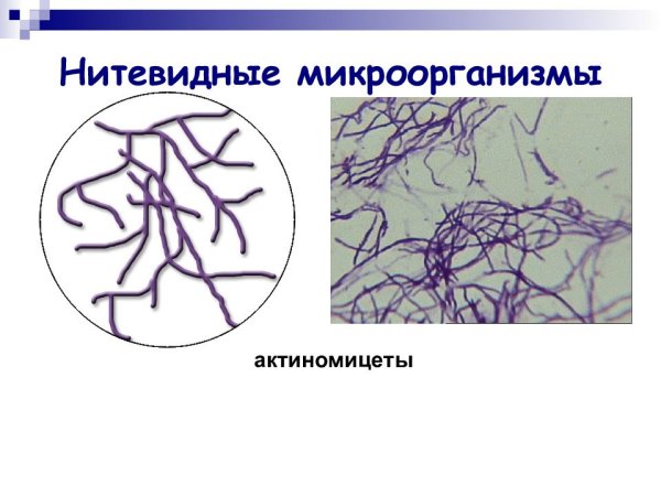 Нитчатые бактерии — актиномицеты