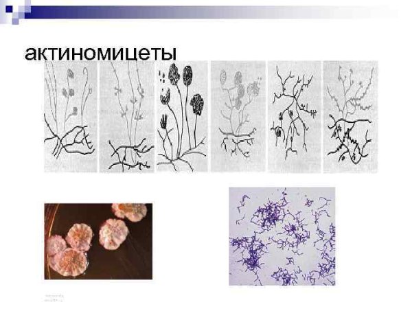 Нитчатые формы бактерий актиномицеты