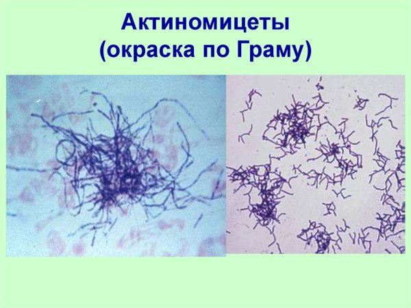 Риккетсии актиномицеты