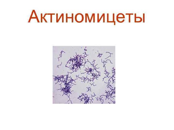 Актиномицеты грамположительные палочки