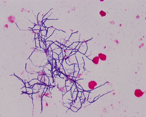 Актиномицеты Streptomyces
