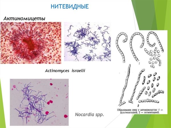 Нитчатые бактерии — актиномицеты