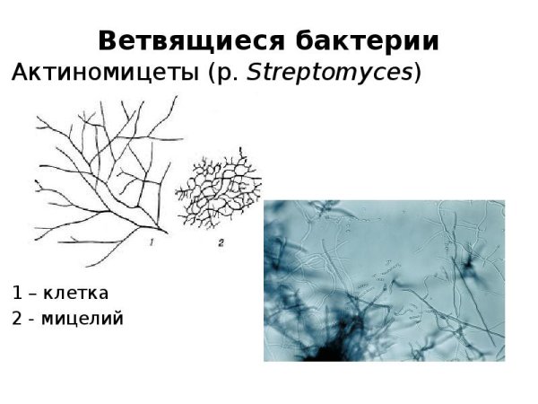 Актиномицеты микроскопия по Граму