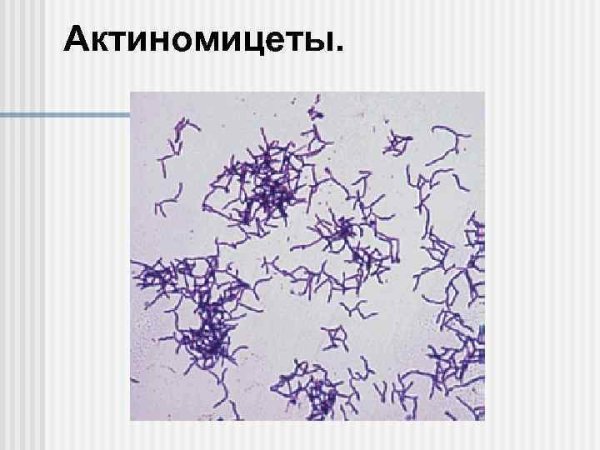 Актиномицеты (actinomycetales)