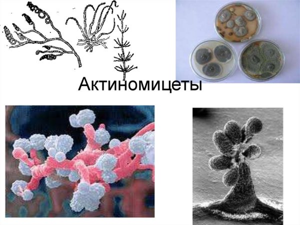 Актиномицеты царство