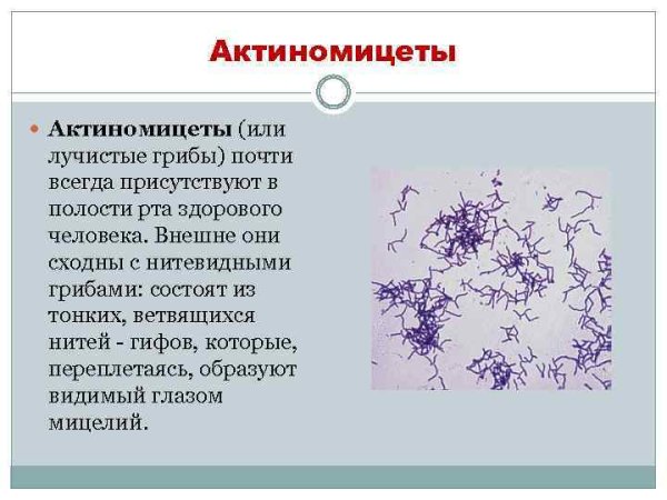 Ветвящиеся актиномицеты
