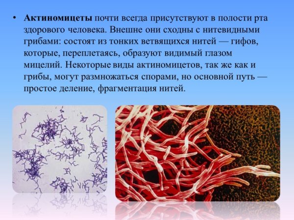 Нокардиоподобные актиномицеты